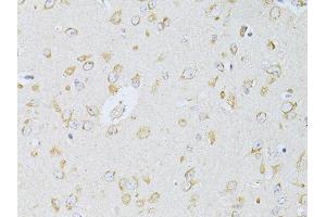 Immunohistochemistry of paraffin-embedded rat brain using NTS antibody (ABIN5998396) at dilution of 1/100 (40x lens). (Neurotensin Antikörper)