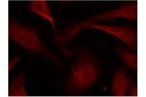 Image no. 3 for anti-Nuclear Factor-kB p65 (NFkBP65) (pSer529) antibody (ABIN196954) (NF-kB p65 Antikörper  (pSer529))