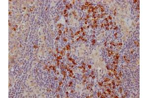 IHC image of ABIN7127437 diluted at 1:100 and staining in paraffin-embedded human lymph node tissue performed on a Leica BondTM system. (Rekombinanter CTLA4 Antikörper)