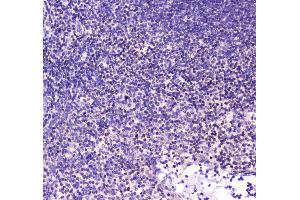 Immunohistochemistry (IHC) image for anti-Core-Binding Factor, beta Subunit (CBFB) (AA 1-182) antibody (ABIN5693076)