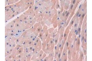 DAB staining on IHC-P;;Samples: Mouse Heart Tissue (FABP3 Antikörper  (AA 1-133))