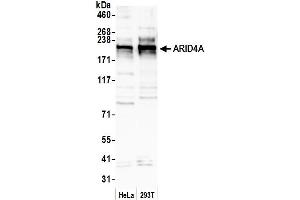 anti-AT Rich Interactive Domain 4A (RBP1-Like) (ARID4A) (AA 900-950) antibody