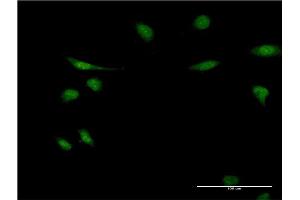 Immunofluorescence of monoclonal antibody to EIF1AY on HeLa cell. (EIF1AY Antikörper  (AA 22-95))