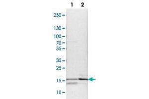 Western blot analysis of lane 1: NIH-3T3 and lane 2: NBT-II cell lysates using FABP4 polyclonal antibody . (FABP4 Antikörper)