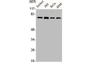 Western Blot analysis of Jurkat 293 HELA A549 cells using Actinin-α1/2/3/4 Polyclonal Antibody (ACTN1/ACTN2/ACTN3/ACTN4 (N-Term) Antikörper)