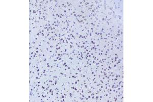 IHC analysis of TPR using anti-TPR antibody (ABIN5693275). (TPR Antikörper)
