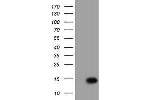 Western Blotting (WB) image for anti-Chromosome 17 Open Reading Frame 37 (C17orf37) antibody (ABIN1501781) (C17orf37 Antikörper)