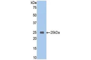 Western blot analysis of recombinant Mouse CPB2/TAFI. (CPB2 Antikörper  (AA 187-327))
