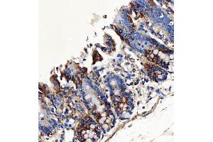 IHC analysis of SH2D4A using anti-SH2D4A antibody (ABIN7601695).