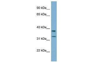 RALGPS2 antibody used at 1 ug/ml to detect target protein. (RALGPS2 Antikörper  (N-Term))
