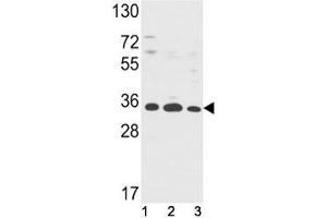 Western blot analysis of Annexin V antibody and (1) HepG2, (2) A2058, (3) T47D lysate. (Annexin V Antikörper  (AA 1-30))