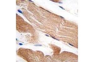 IHC analysis of FFPE human skeletal muscle tissue stained with ILK1 antibody (ILK Antikörper  (AA 151-180))