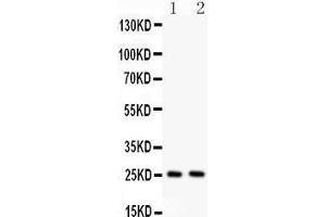 Anti- TNF alpha Picoband antibody, Western blotting All lanes: Anti TNF alpha  at 0. (TNF alpha Antikörper  (AA 80-227))