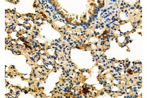 ABIN6263519 and ABIN6276723 at 1/100 staining Mouse lung tissue by IHC-P.