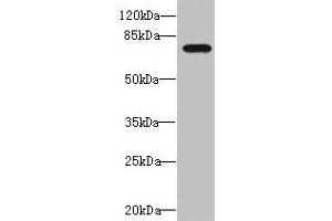 Western blot All lanes: DUSP16 antibody at 1. (DUSP16 Antikörper  (AA 416-665))
