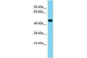 Host: Rabbit Target Name: CCDC121 Sample Type: Fetal Brain lysates Antibody Dilution: 1. (CCDC121 Antikörper  (Middle Region))