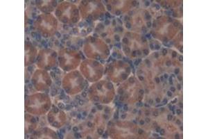 Used in DAB staining on fromalin fixed paraffin- embedded Kidney tissue (AASS Antikörper  (AA 477-926))