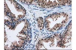 Immunohistochemical staining of paraffin-embedded Human liver tissue using anti-C17orf28 mouse monoclonal antibody. (HID1/DMC1 Antikörper)