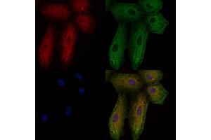 ABIN6257398 and ABIN6276108 staining  cells by IF/ICC. (Rho-related GTP-binding protein Antikörper  (C-Term))