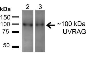 Western blot analysis of Human HeLa and 293T cell lysates showing detection of ~100kDa UVRAG protein using Rabbit Anti-UVRAG Polyclonal Antibody . (UVRAG Antikörper  (FITC))