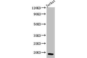 Western Blot Positive WB detected in: Jurkat whole cell lysate All lanes: CD247 antibody at 3 μg/mL Secondary Goat polyclonal to rabbit IgG at 1/50000 dilution Predicted band size: 19 kDa Observed band size: 19 kDa