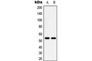 Western blot analysis of 5-HT2B expression in HeLa (A), HT29 (B) whole cell lysates. (Serotonin Receptor 2B Antikörper  (N-Term))