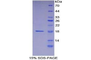 SDS-PAGE analysis of Human Laminin alpha 1 Protein. (Laminin alpha 1 Protein)