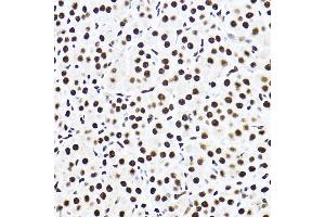Immunohistochemistry (IHC) image for anti-Splicing Factor 3a, Subunit 3, 60kDa (SF3A3) (AA 292-501) antibody (ABIN1682671)