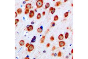Immunohistochemical analysis of mGLUR5 staining in human brain formalin fixed paraffin embedded tissue section.
