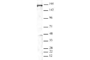 PBRM1 antibody (pAb) tested by Western blot. (Polybromo 1 Antikörper  (N-Term))