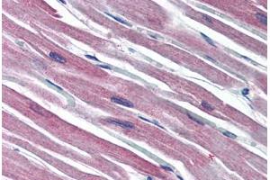 Human Heart (formalin-fixed, paraffin-embedded) stained with S100A1 antibody ABIN790334 at 10 ug/ml followed by biotinylated goat anti-rabbit IgG secondary antibody ABIN481713, alkaline phosphatase-streptavidin and chromogen. (S100A1 Antikörper  (C-Term))