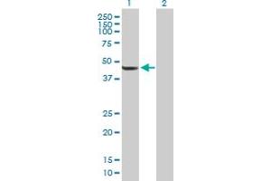 Western Blot analysis of TBL2 expression in transfected 293T cell line by TBL2 MaxPab polyclonal antibody. (TBL2 Antikörper  (AA 1-447))