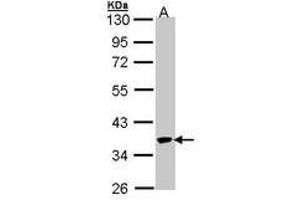 Image no. 1 for anti-Speckle-Type POZ Protein (SPOP-B) (AA 1-193) antibody (ABIN467492) (SPOP-B Antikörper  (AA 1-193))