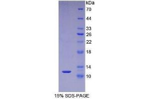SDS-PAGE (SDS) image for S100 Calcium Binding Protein A5 (S100A5) (AA 1-92) protein (His tag) (ABIN1080727)