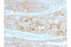 Formalin-fixed, paraffin-embedded human Kidney stained with ROR2 Mouse Monoclonal Antibody (ROR2/1912). (ROR2 Antikörper)