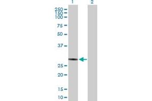 Western Blot analysis of NUBPL expression in transfected 293T cell line by NUBPL MaxPab polyclonal antibody. (NUBPL Antikörper  (AA 1-289))
