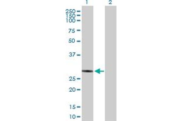 NUBPL antibody  (AA 1-289)