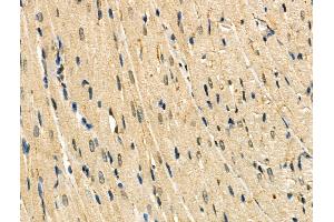 ABIN6257153 and ABIN6274164 at 1/100 staining Rat heart tissue by IHC-P.