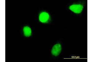 Immunofluorescence of monoclonal antibody to HOXC4 on HeLa cell. (HOXC4 Antikörper  (AA 160-264))