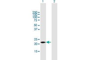 Western Blot analysis of GSTK1 expression in transfected 293T cell line by GSTK1 MaxPab polyclonal antibody. (GSTK1 Antikörper  (AA 1-226))