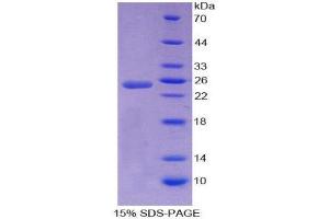 SDS-PAGE (SDS) image for APOBEC1 Complementation Factor (A1CF) (AA 389-587) protein (His tag) (ABIN2124032) (A1CF Protein (AA 389-587) (His tag))
