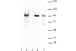 BORIS / CTCFL antibody (pAb) tested by Western blot. (CTCFL Antikörper  (N-Term))