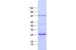 CEP63 Protein (His tag)