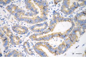 anti-Acetyl-CoA Acyltransferase 2 (ACAA2) antibody