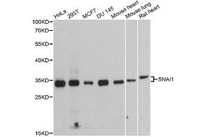 Western blot analysis of extracts of various cell lines, using SNAI1 antibody (ABIN4905248) at 1:1000 dilution.