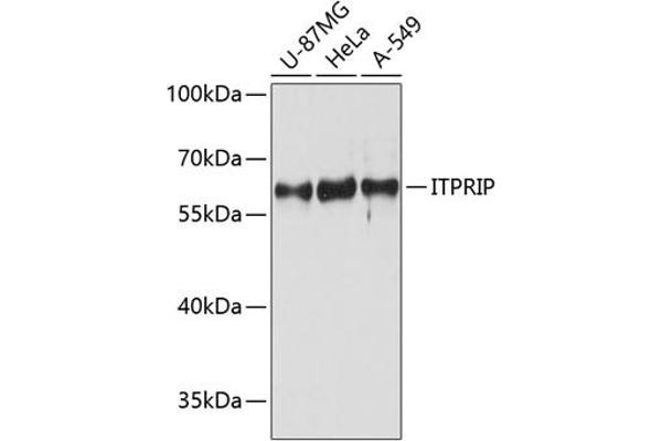 ITPRIP Antikörper  (AA 101-290)