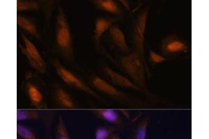 Immunofluorescence (IF) image for anti-Ubiquitin-Conjugating Enzyme E2S (UBE2S) antibody (ABIN7261113)
