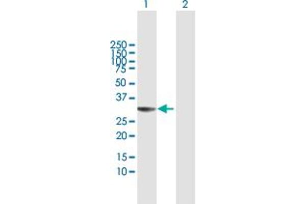 THAP1 Antikörper  (AA 1-213)