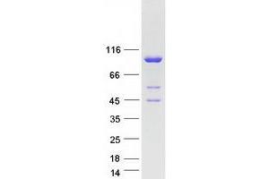 Western Blotting (WB) image for Molybdenum Cofactor Sulfurase (MOCOS) protein (Myc-DYKDDDDK Tag) (ABIN2726217)