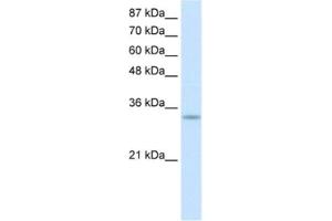 Western Blotting (WB) image for anti-Protein Kinase, Interferon-Inducible Double Stranded RNA Dependent Activator (PRKRA) antibody (ABIN2462150) (PRKRA Antikörper)
